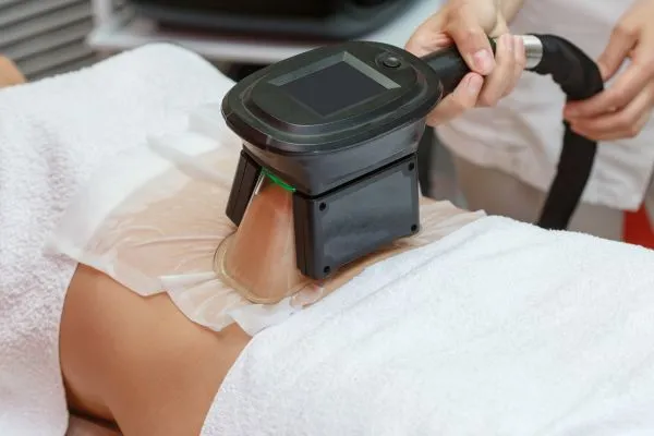 Image of person having fat freezing treatment to help weight gain Poulton