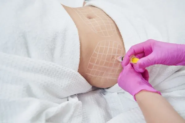 image of fat dissolving injections on love handles to help combat weight gain Poulton